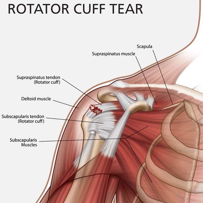 Common Shoulder Problems Wilmington Health