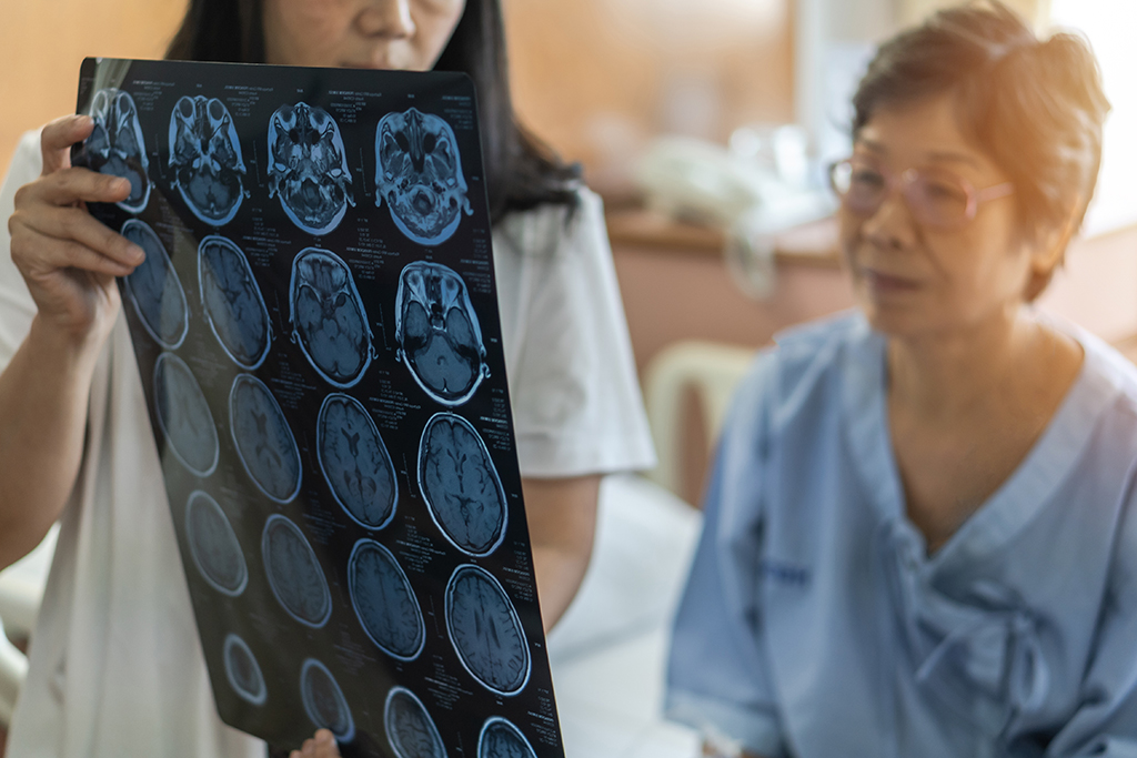 Medical professional showing older female patient neurodegenerative images