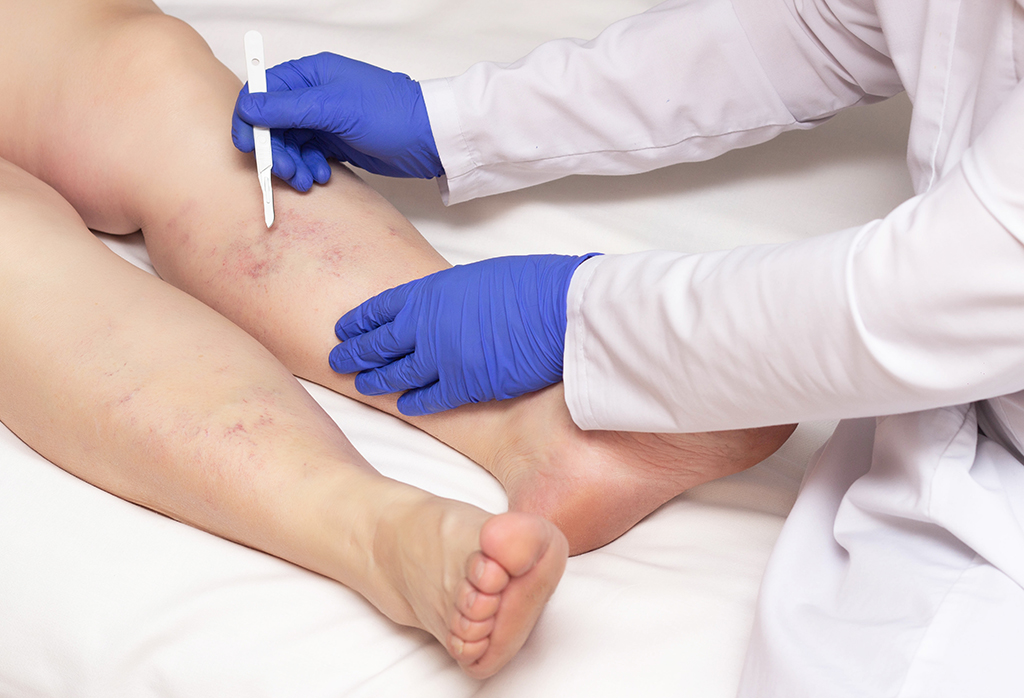 Doctor vascular surgeon holds a scalpel near the legs of a woman