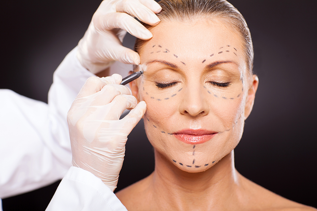 Middle aged woman preparing for plastic surgery
